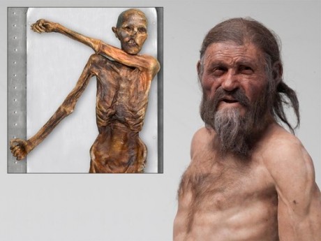 Otzi the Iceman